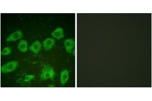 Immunofluorescence (IF) image for anti-Tyrosine Hydroxylase (TH) (AA 10-59) antibody (ABIN2888583) (Tyrosine Hydroxylase 抗体  (AA 10-59))