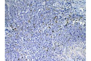 IHC analysis of IL33 using anti-IL33 antibody . (IL-33 抗体  (AA 102-264))
