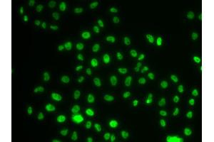 Immunofluorescence analysis of MCF-7 cells using PHIP antibody. (PHIP 抗体)