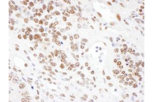 Immunohistochemistry (IHC) image for anti-Serrate RNA Effector Molecule Homolog (SRRT) (AA 826-876) antibody (ABIN7453421) (SRRT 抗体  (AA 826-876))
