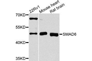 Western blot analysis of extracts of various cell lines, using SMAD6 antibody (ABIN5970214) at 1/1000 dilution. (SMAD6 抗体)