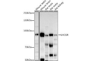 Western blot analysis of extracts of various cell lines, using LHCGR antibody (ABIN6128180, ABIN6143185, ABIN6143186 and ABIN6221866) at 1:500 dilution. (LHCGR 抗体  (AA 200-360))