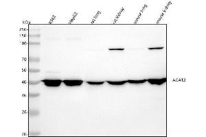 Western blot analysis of ACAT2 using anti-ACAT2 antibody (ABIN7603877).