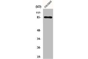 Western Blot analysis of COLO205 cells using Fyb Polyclonal Antibody (FYB1 抗体  (C-Term))