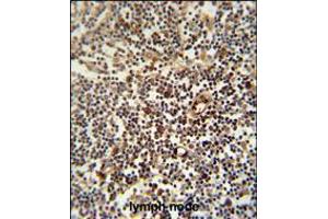 LAPTM5 antibody immunohistochemistry analysis in formalin fixed and paraffin embedded human lymph node followed by peroxidase conjugation of the secondary antibody and DAB staining. (LAPTM5 抗体  (N-Term))