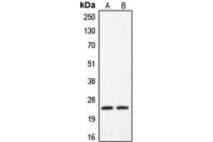 Western blot analysis of Claudin 2 expression in HeLa (A), A431 (B) whole cell lysates. (Claudin 2 抗体  (C-Term))