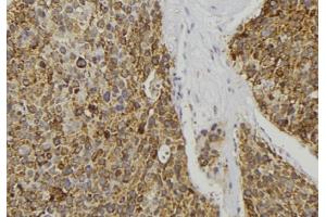 ABIN6277085 at 1/100 staining Human pancreas tissue by IHC-P. (REG3A 抗体  (Internal Region))