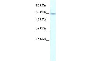 WB Suggested Anti-ZNF543 Antibody Titration:  0. (ZNF543 抗体  (Middle Region))