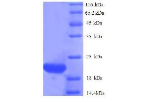 SDS-PAGE (SDS) image for ISG15 Ubiquitin-Like Modifier (ISG15) (AA 2-157), (full length) protein (His tag) (ABIN1047869)