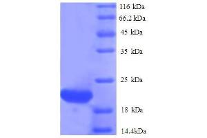 ISG15 Ubiquitin-Like Modifier (ISG15) (AA 2-157), (full length) protein (His tag) (ISG15 Protein (AA 2-157, full length) (His tag))