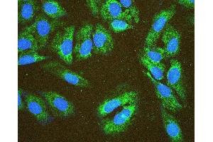 IF analysis of EIF4G1 using anti-EIF4G1 antibody (ABIN7601860).