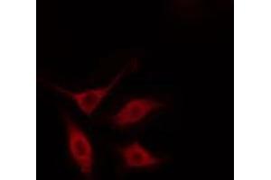 ABIN6274485 staining HeLa cells by IF/ICC. (SERINC2 抗体  (Internal Region))
