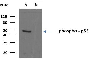 Western blotting analysis of phosphorylated human p53 using mouse monoclonal antibody FP3. (p53 抗体  (pSer392))
