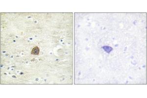 Immunohistochemical analysis of paraffin-embedded human brain tissue using CaMKII (Phospho-Thr305) antibody (left)or the same antibody preincubated with blocking peptide (right). (CAMK2A 抗体  (pThr305))