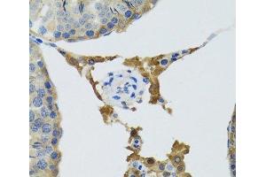 Immunohistochemistry (Paraffin-embedded Sections) (IHC (p)) image for anti-Phospholipase A2, Group IID (PLA2G2D) antibody (ABIN7011300)