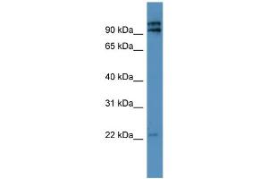 WB Suggested Anti-MRPL49 Antibody Titration: 0.