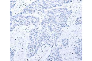 Immunohistochemistry (IHC) image for anti-Gastrin-Releasing Peptide Receptor (GRPR) antibody (ABIN1872904) (GRPR 抗体)