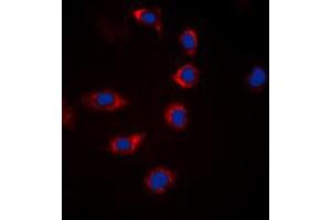 Immunofluorescent analysis of BAD (pS155) staining in Hela cells. (BAD 抗体  (C-Term, pSer155))