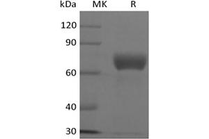 Western Blotting (WB) image for Cytokine Receptor-Like Factor 2 (CRLF2) (Active) protein (Fc Tag) (ABIN7319829)