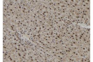ABIN6273051 at 1/100 staining Mouse liver tissue by IHC-P. (Importin 4 抗体  (Internal Region))