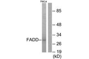 Western blot analysis of extracts from HeLa cells, treated with PMA 125ng/ml 30', using FADD (Ab-194) Antibody. (FADD 抗体  (AA 159-208))