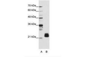 Image no. 2 for anti-Transmembrane Emp24 Protein Transport Domain Containing 4 (TMED4) (N-Term) antibody (ABIN202093) (TMED4 抗体  (N-Term))
