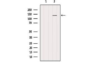 Western blot analysis of extracts from B16F10, using MN1 Antibody. (Meningioma 1 抗体  (Internal Region))