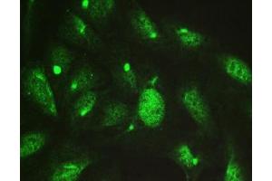 Immunocytochemistry (ICC) image for anti-Chaperonin Containing TCP1, Subunit 4 (Delta) (CCT4) antibody (ABIN4952801)
