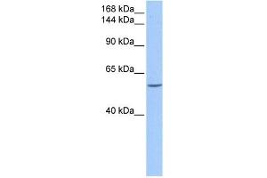DLC1 antibody used at 0. (DLC1 抗体  (C-Term))