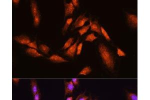 Immunofluorescence analysis of C6 cells using BTRC Polyclonal Antibody at dilution of 1:100. (BTRC 抗体)
