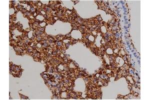 ABIN6267521 at 1/200 staining Mouse lung2. (ZAP70 抗体  (pTyr319))