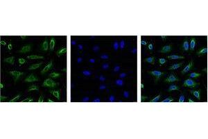 Immunofluorescence (IF) analysis of HeLa with antibody (Left) and DAPI (Right) diluted at 1:100. (Aquaporin 4 抗体)