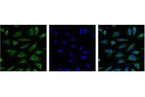 Immunofluorescence (IF) analysis of HeLa with antibody (Left) and DAPI (Right) diluted at 1:100. (Aquaporin 4 抗体)