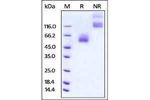 Rat CD47, Fc Tag on SDS-PAGE under reducing (R) and no-reducing (NR) conditions.