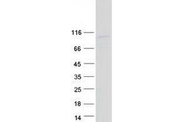 TTLL11 Protein (Transcript Variant 1) (Myc-DYKDDDDK Tag)