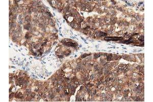 Immunohistochemistry (IHC) image for anti-DnaJ (Hsp40) Homolog, Subfamily A, Member 2 (DNAJA2) antibody (ABIN1497861) (DNAJA2 抗体)