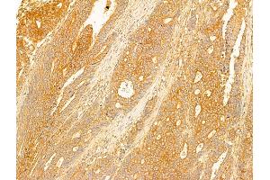 anti-Nicotinate phosphoribosyltransferase (NAPRT) (Internal Region) antibody