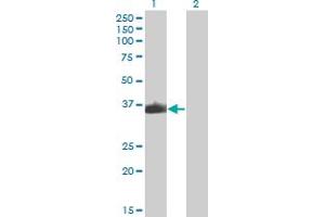 Western Blot analysis of ZNF187 expression in transfected 293T cell line by ZNF187 monoclonal antibody (M04), clone 3E11. (ZNF187 抗体  (AA 1-325))