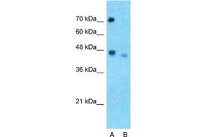 Western Blotting (WB) image for anti-SRY (Sex Determining Region Y)-Box 4 (SOX4) (N-Term) antibody (ABIN2780469)
