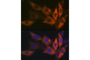Immunofluorescence analysis of NIH-3T3 cells using AMPKβ1 Rabbit mAb (ABIN7269654) at dilution of 1:100 (40x lens). (PRKAB1 抗体)