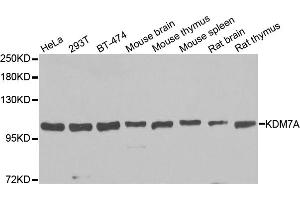Western blot analysis of extracts of various cell lines, using KDM7A antibody. (JHDM1D 抗体)