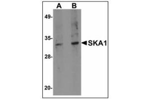 Western blot analysis of SKA1 in A549 cell lysate with SKA1 antibody at (A) 0. (SKA1 抗体  (C-Term))