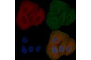 CEP104 Mouse Monoclonal Antibody staining Hela cells by IF/ICC. (KIAA0562 抗体)
