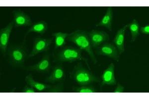Immunofluorescence analysis of A549 cells using MPG Polyclonal Antibody (MPG 抗体)