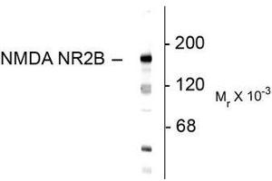 Image no. 1 for anti-Glutamate Receptor, Ionotropic, N-Methyl D-Aspartate 2B (GRIN2B) (N-Term) antibody (ABIN372684) (GRIN2B 抗体  (N-Term))