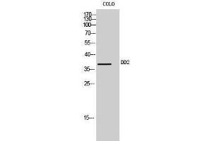 Western Blotting (WB) image for anti-Aldo-keto Reductase Family 1, Member C2 (AKR1C2) (Internal Region) antibody (ABIN3184266)