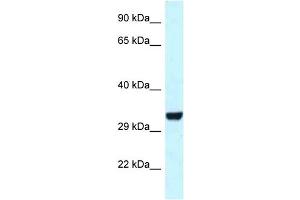 WB Suggested Anti-Hey1 Antibody   Titration: 1. (HEY1 抗体  (C-Term))
