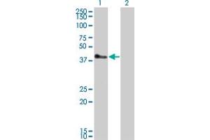 Western Blot analysis of TRIM52 expression in transfected 293T cell line by TRIM52 monoclonal antibody (M01), clone 6D5. (TRIM52 抗体  (AA 201-297))