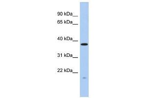 RWDD2A antibody used at 1 ug/ml to detect target protein. (RWDD2A 抗体  (N-Term))
