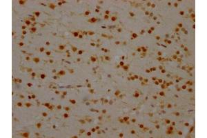 IHC image of ABIN7127546 diluted at 1:100 and staining in paraffin-embedded human brain tissue performed on a Leica BondTM system. (Recombinant SYNCRIP 抗体)